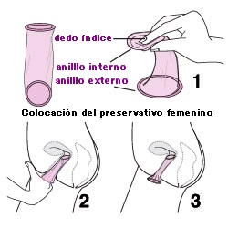 Femalee Condom